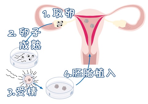 胚胎培养箱